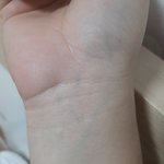 내 혈관 파란색 같애 <b>녹색</b> 같애?