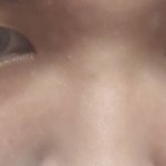 이거 다크<b>써클</b>이야 피부처진거야?