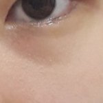 눈밑 <b>처짐</b>인거야??