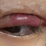 혐주의 쌍수 1일차 <b>라인</b>봐쥐ㅠ