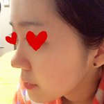 [꼭댓글부탁] (추가)코<b>필러</b> 이상하지않아요???
