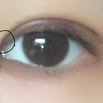 <b>실밥</b> 풀고 왔는데 앞트임이 이상해ㅠㅠ