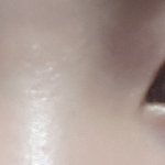 한 쪽 쌍커풀에 <b>주름</b>이ㅜㅜㅜ
