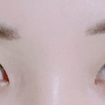 쌍수 후기