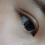 쌍커풀 라인 높은거야?