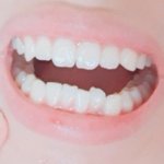 나 <b>이빨</b> 많이 못생겼냐