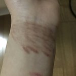 [댓글부탁해] 이거 <b>자해</b>한 것 같아?