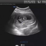 [방탄소년단] 와...이<b>애기</b>가 애들한테 삼촌이라고그러겠네...