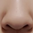 [조언부탁해] (<b>코사진</b>있음)나 <b>코</b> 수술 꼭 해야겠지..?