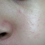 피부 이거 먼<b>지아</b>는사람 ㅠㅠ?