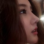 이코로 성형어떰?