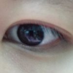 [조언부탁] 눈재수술 고민중(+조언 구함)