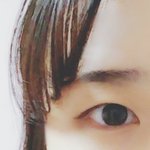 [꼭조언부탁] 쌍수 하는 게 나을까요...ㅠㅠ