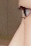 [댓글부탁해] 코필러 부작용 <b>심해</b>???