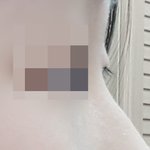 [댓글부탁해] 나 콧대<b>필러</b> 맞을까??