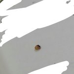 머리에서 <b>피지</b> 짱큰거나옴 ㄱㅁㅉ