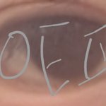 <b>이눈</b> 쌍수했다안했다추반