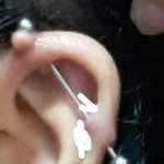 [드루와] 이거 <b>물집</b>인지 살튀인지 추반좀