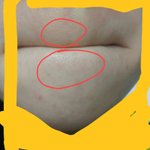 [댓글부탁해] 약혐)턱이랑인중에<b>피지</b>