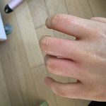[댓글부탁해] 손에 <b>화상</b>을 입었어ㅠㅠㅠㅠ도와줘
