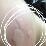 [댓글부탁해] 사진ㅇ)윤곽<b>주사</b> 부작용