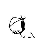 [댓글부탁해] 나 쌍수했는데 자꾸 <b>눈알</b>이 아파 어떡해?