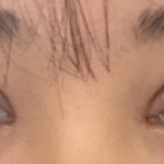 나 붓기빠지면 <b>쌍</b><b>액</b>한거랑 비슷하게 될거같니 ㅠ