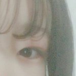 [ㅠㅠㅠ] 아 미친 다래끼 났는데 <b>개아픔</b>..