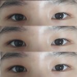 [댓글부탁해] <b>쌍수</b>하면 어떨 것 같아요?
