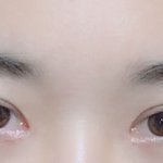쌍수 라인 너무 위로잡은걸까?ㅠㅠ