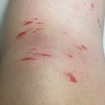 혐주의) 눈썹<b>칼</b>로 다리밀다가 베임ㅠ