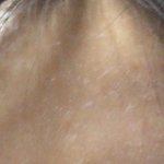 이거 <b>각질</b>어떻게 없애야돼ㅠㅠㅠㅠㅠ혐이야