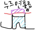 [댓글부탁해] 나 <b>치아</b> 왜 이럴까 ㅜㅠㅠㅜ