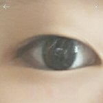 나 <b>속</b><b>쌍</b>인데 쌍수 할까ㅠ? 추반좀