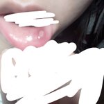 약혐)나 <b>구내염</b> ㄹㅇ 개크개남..