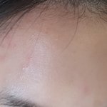 생각치 못한 피부트러블 원인