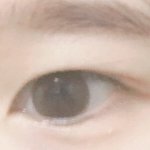 [조언부탁해] 쌍수 할건데 <b>뒷</b>트임도 해야 할까ㅠㅠ