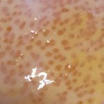 [환공<b>포주</b>의] 계란 노른자 이런데 먹어도 대?