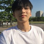 손가락 <b>금</b>갔던데가 아픈데 어캄??ㅈㅂ