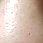 [댓글부탁해] 혐오사진) 존.나 큰 피지 뽑아서 코에 <b>구멍남</b>