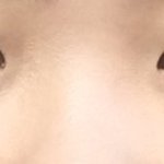 쌍수하면 어떨것<b>가트</b>??