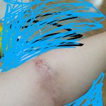 (<b>약</b>혐)<b>무슨약</b> 발라야될까