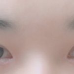 사진ㅇ)<b>쌍수</b> 40일차 <b>라인</b>괜찮아?