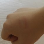 [댓글부탁해] 나 엄마가 물건던지는거 막다가 멍들었어