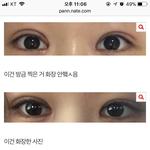 [댓글부탁해] 나 쌍수했는데 좀 봐줘 ㅠㅠ