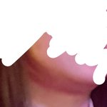 [댓글부탁해] 와 ㅅㅂ나 <b>턱살</b> 어떡하냐