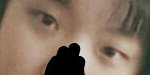 [댓글부탁해] 나 <b>눈</b> <b>수술</b>
