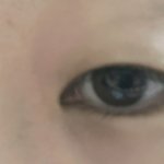 [드루와] 눈두<b>덩이</b>에 살 많은사람~~~~