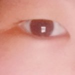 쌍수할때 트임 어떤거해<b>야행</b>