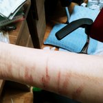 [댓글부탁해] 이거 <b>자해</b> 상처같아?